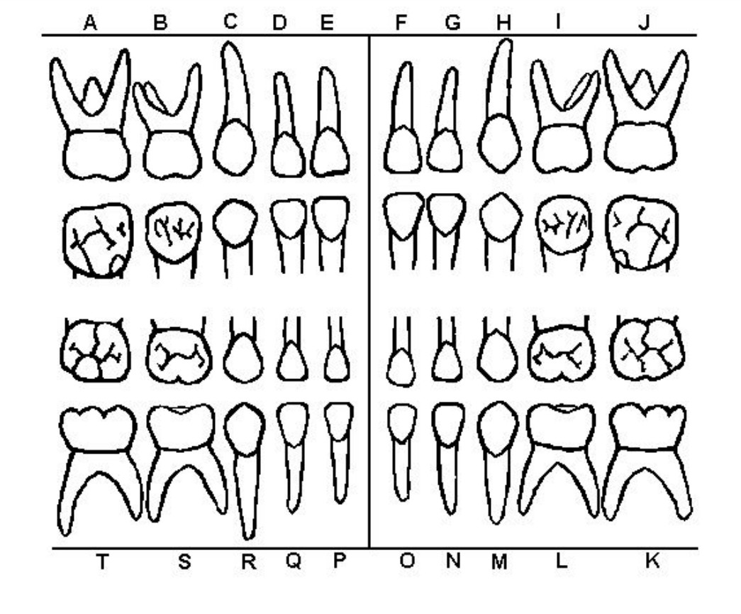 Tooth Chart Child Template